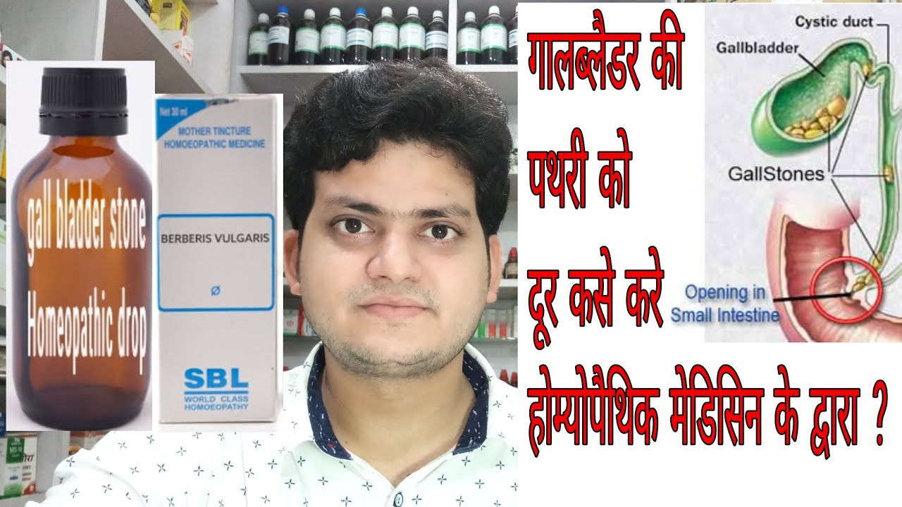Gall bladder stone ! Homeopathic medicine for Gall bladder stone ? Explain !