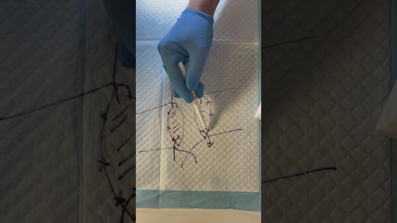Microsurgery Masterclass at CUPRASS #medicalstudent #bss #meded #microsurgery #medtutor