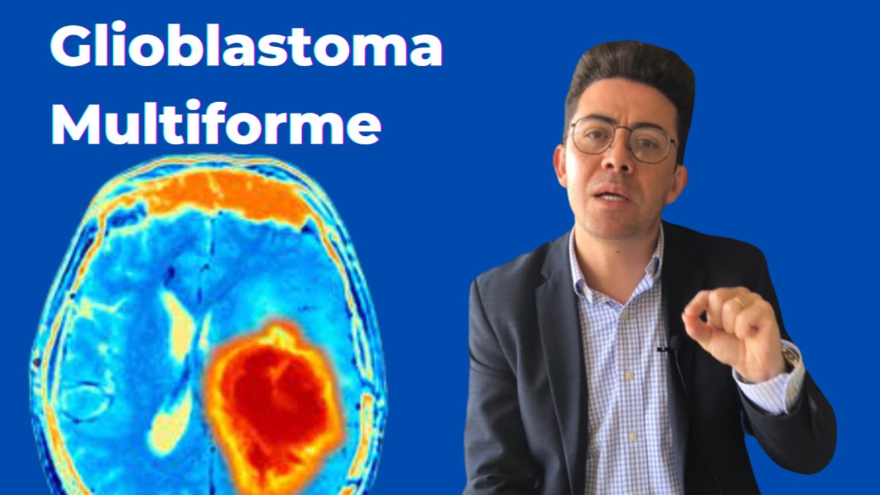 Glioblastoma Multiforme. O que vamos fazer Dr?