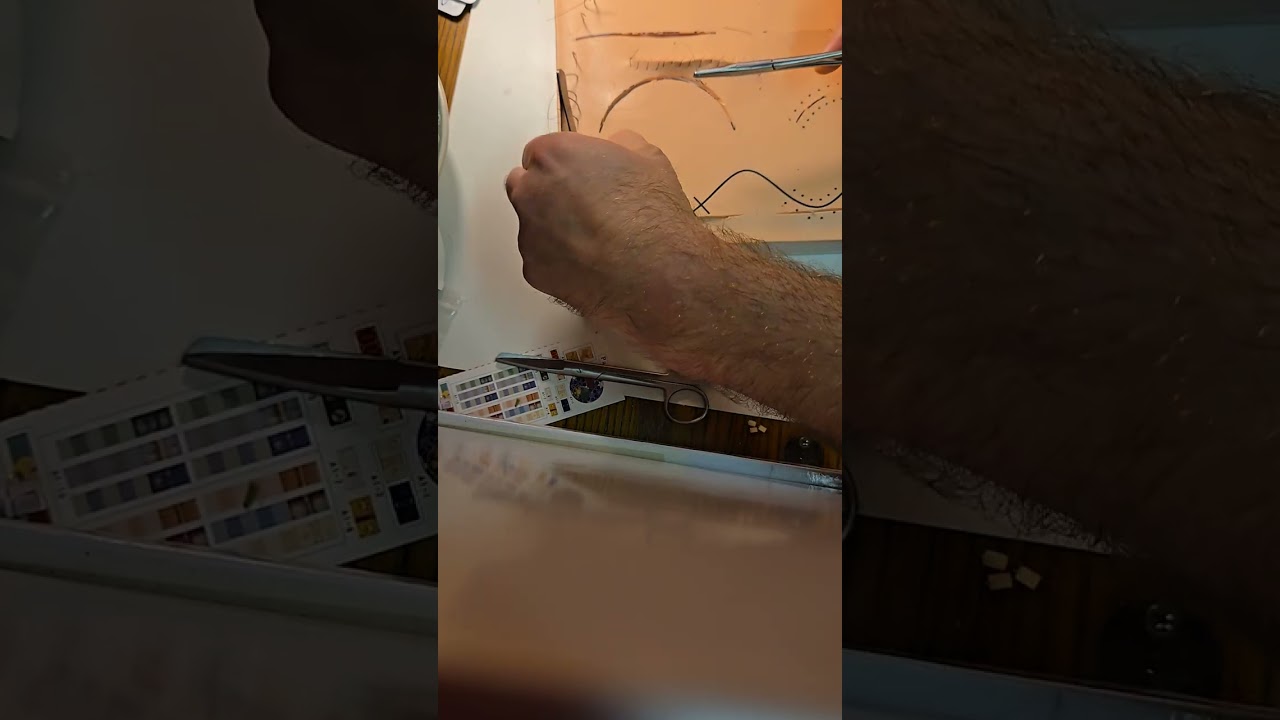 Figure 8 Stitch