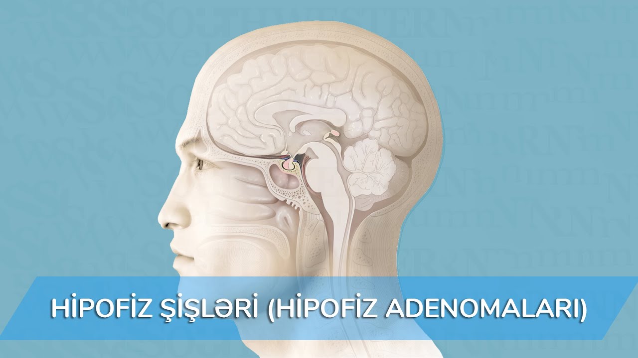 Endokrinoloq otağı – Hipofiz Adenomaları