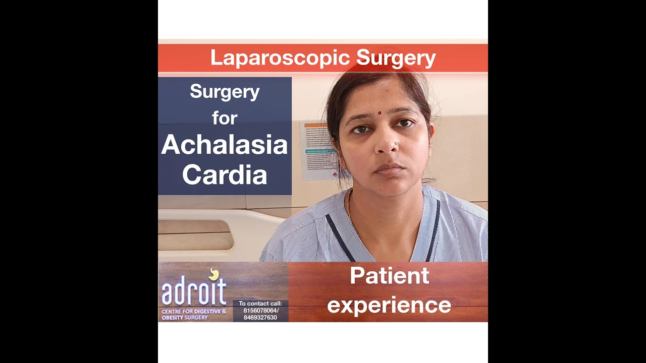एकेलेसिआ कार्डिआ लैप्रोस्कोपिक ऑपरेशन Laparoscopic surgery for Achalasia Cardia: Patient review
