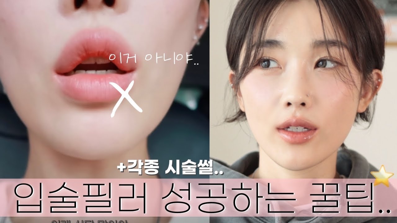 백만원 태운 얼태기 극복주간🧚🏻‍♀️feat.입술필러 성공하는 꿀팁⭐️(보톡스, 슈링크 유니버스, 백옥주사, 토닝, 홈케어...)