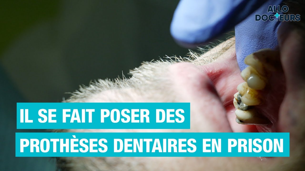 🦷⛓ Le quotidien du cabinet dentaire de la PRISON de Nancy-Maxéville  4/5