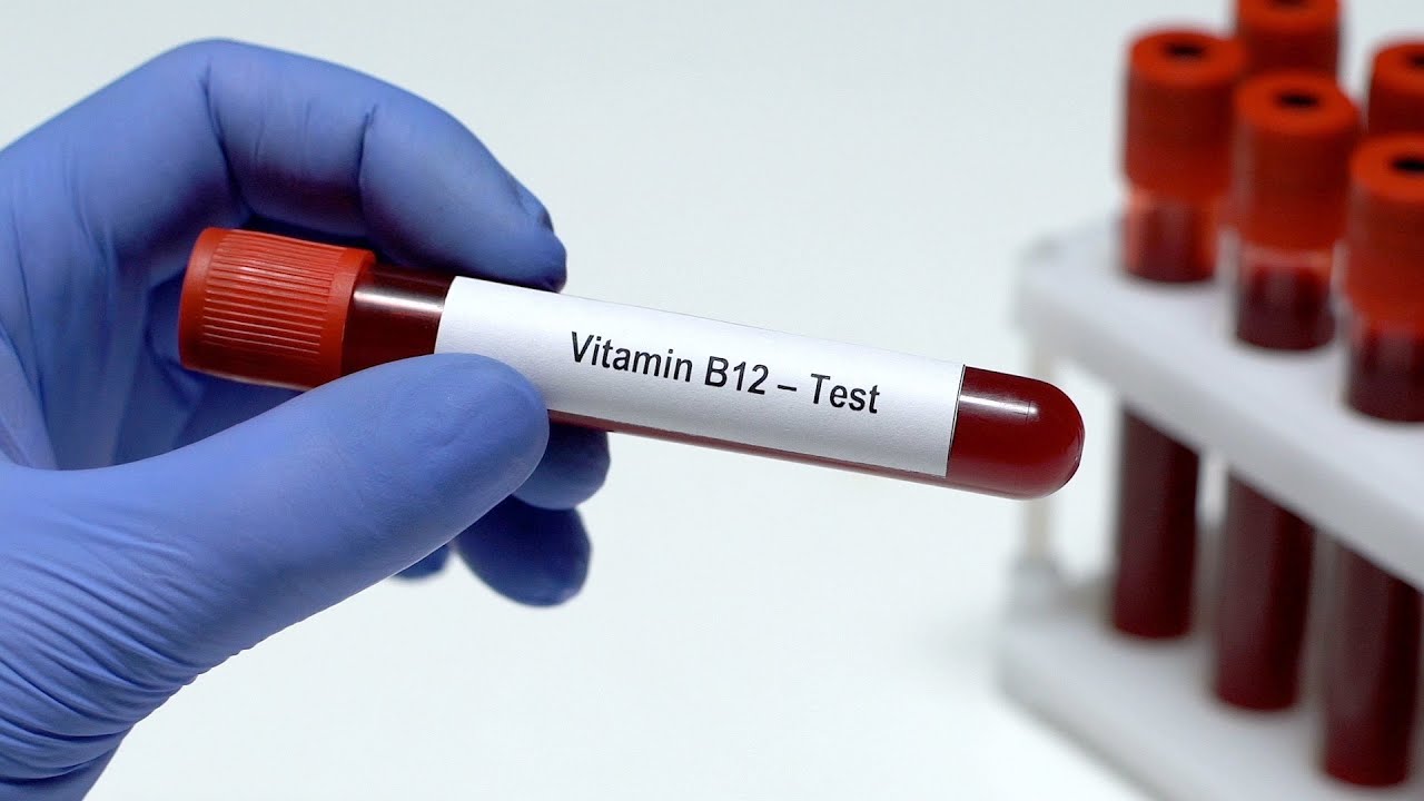 🔬Wszystko, co musisz wiedzieć o Witaminie B12 - Kobalaminie 💊