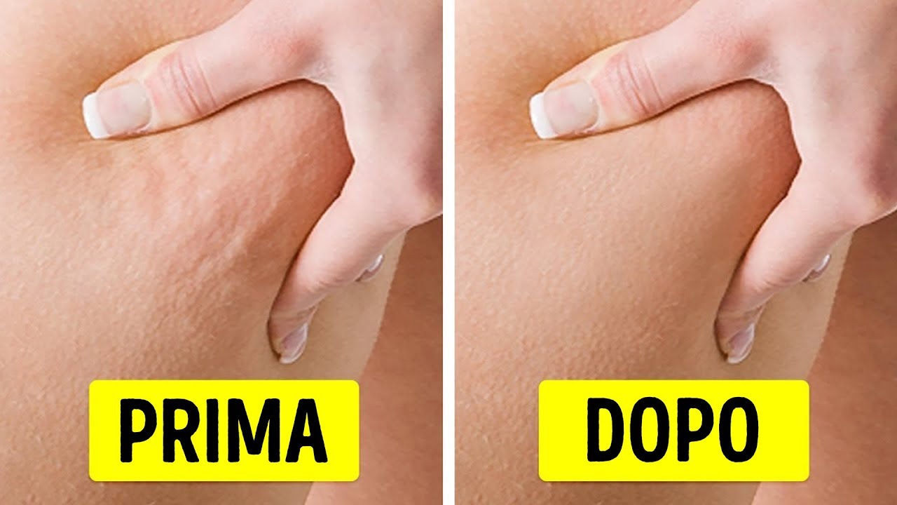 6 esercizi per sbarazzarsi della cellulite in 2 settimane
