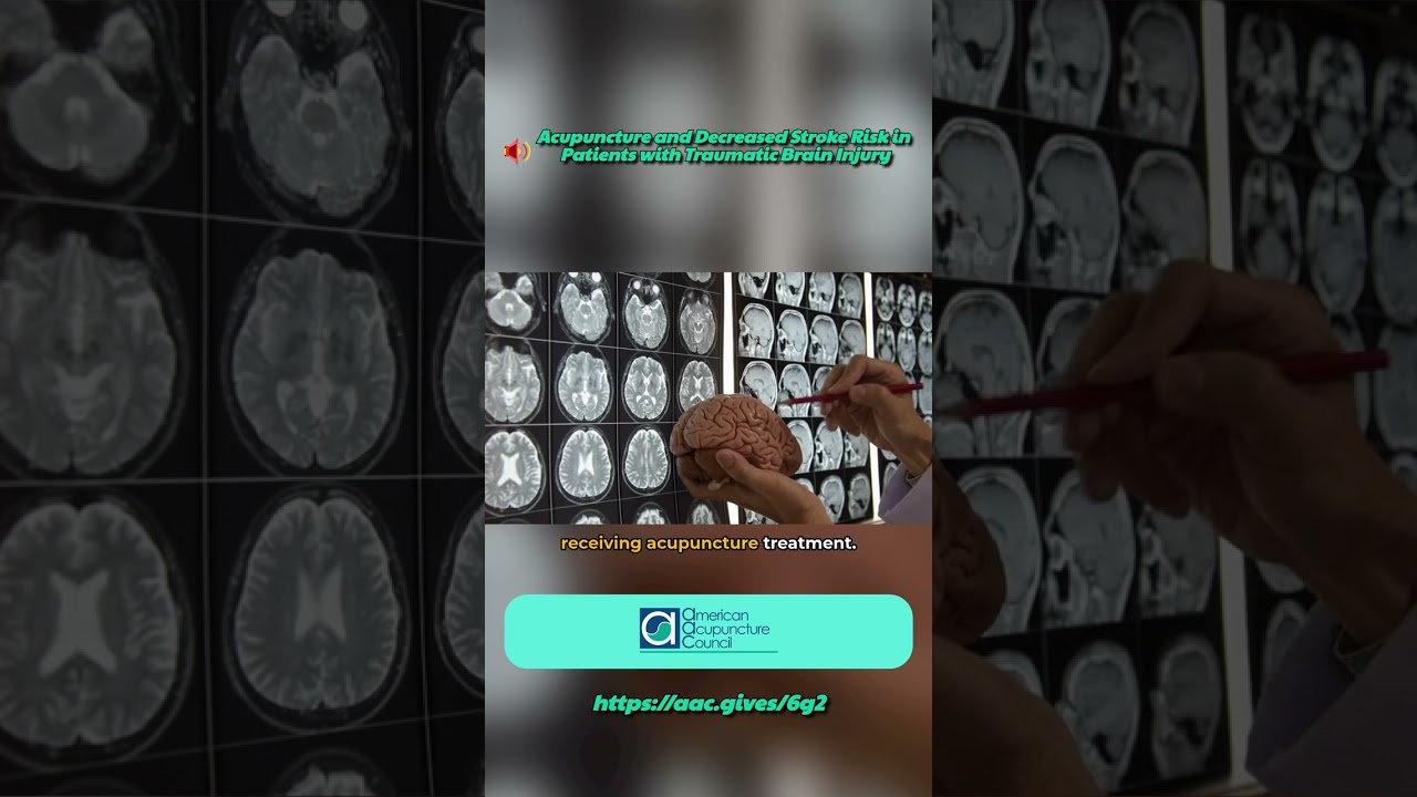 Acupuncture and Decreased Stroke Risk in Patients with Traumatic Brain Injury😃🔊👍📹⭐