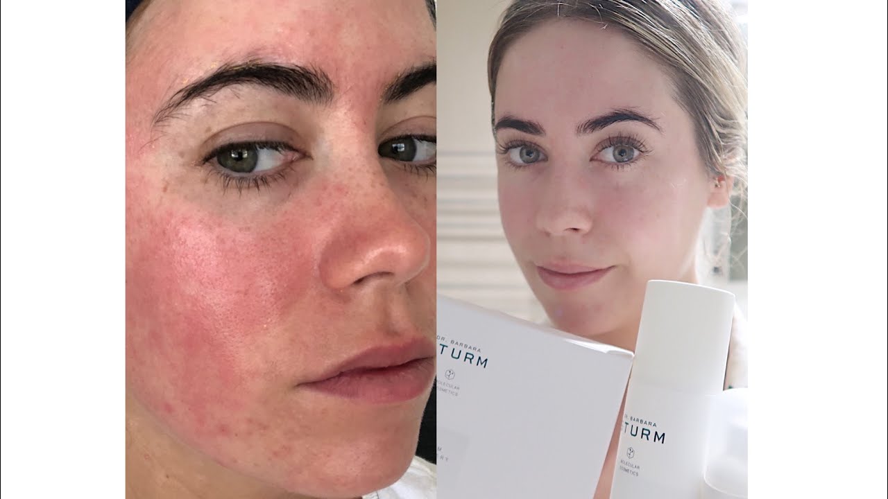 DR. BARBARA STURM SKINCARE REVIEW