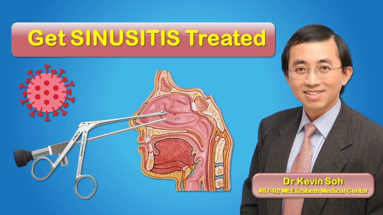 Diagnosis, medicines, sprays, & surgery information related to sinusitis, sinus disease, & allergy.