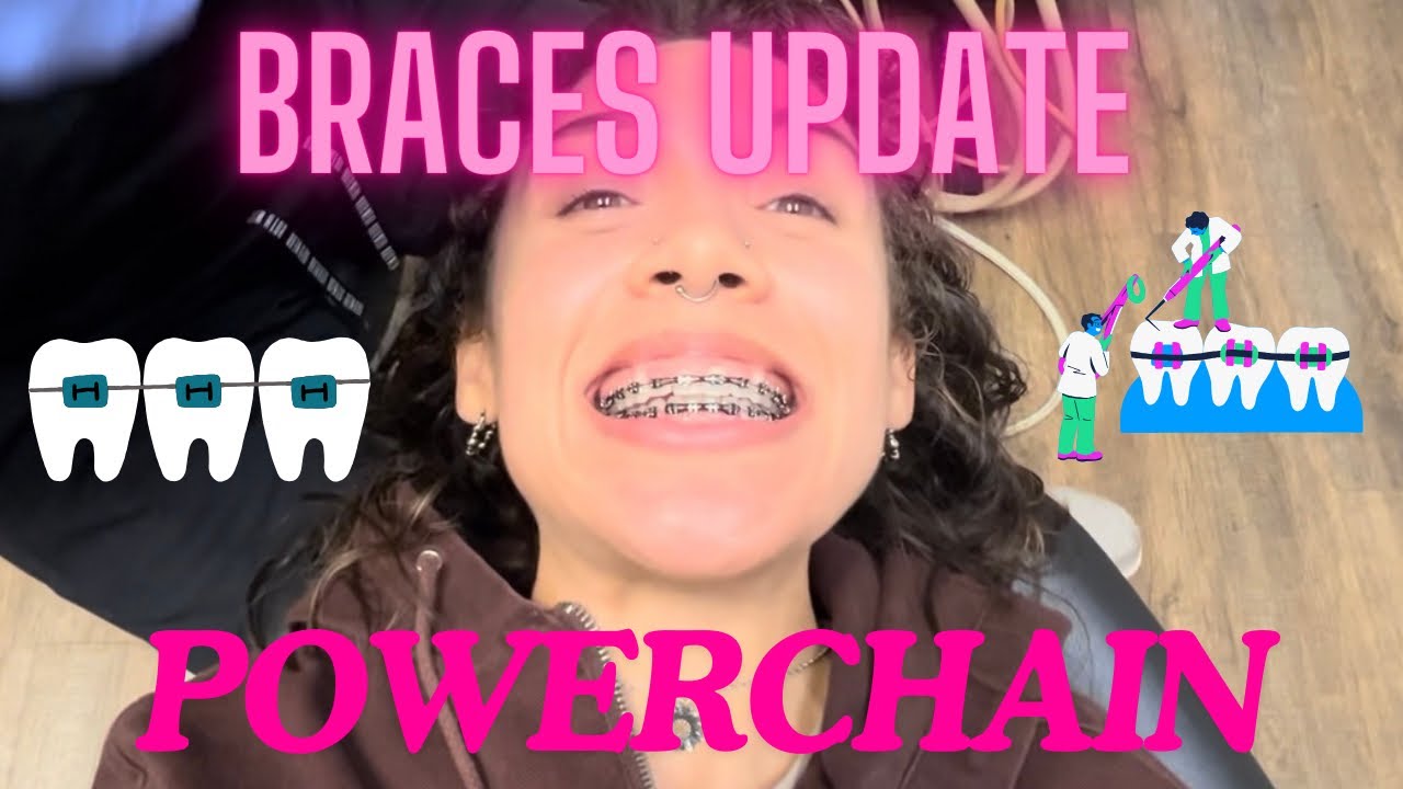 Come with me to get my braces ruberbands changed! 😬I got power chains!