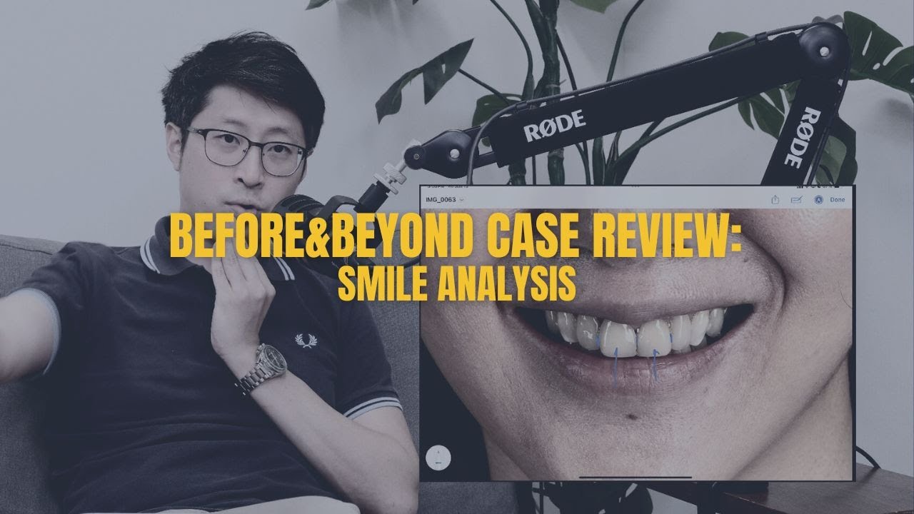 Smile Makeover 101: What You Need to Know | BEFORE & BEYOND EP1