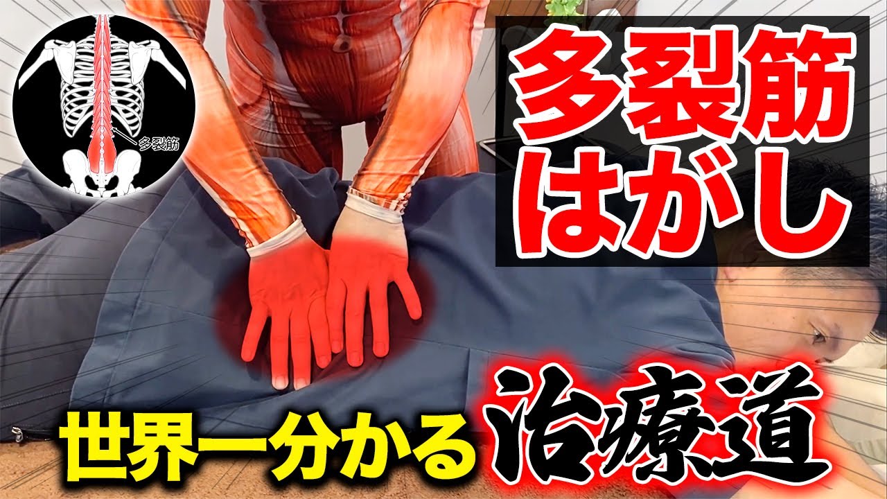 【※超有料級※】見るだけで多裂筋治療が見極められる神ワザと㊙治療テクニック！