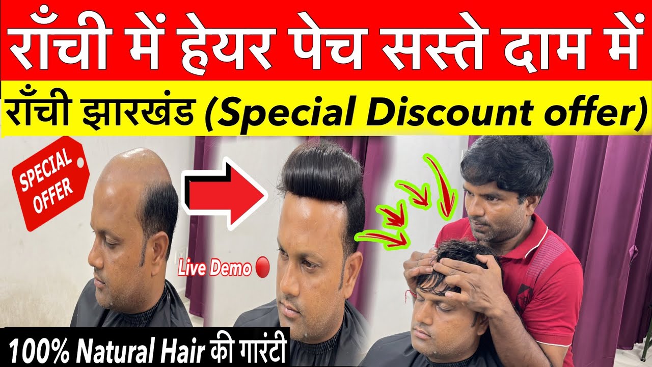 Hair Patch Ranchi | हेयर पेच सबसे सस्ता अब रांची में | Hair Patch For Men in Ranchi 2024
