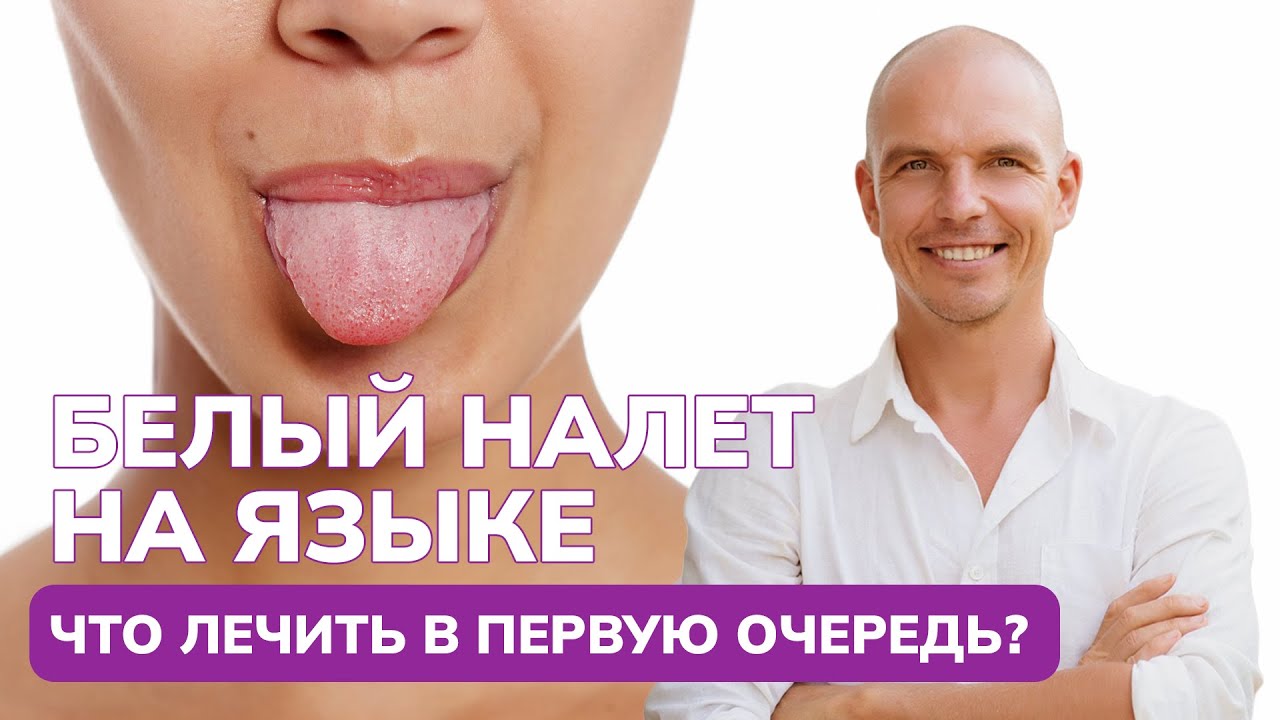 Белый налет на языке? Как просто очистить язык от налета