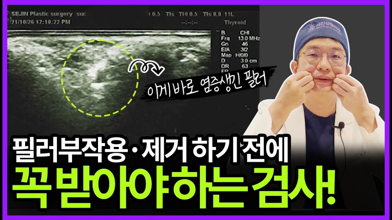 필러부작용 발생시 OOO검사는 필수입니다!｜#필러제거 #이물질제거｜フィラー施術の前に受けなければならない必須検査