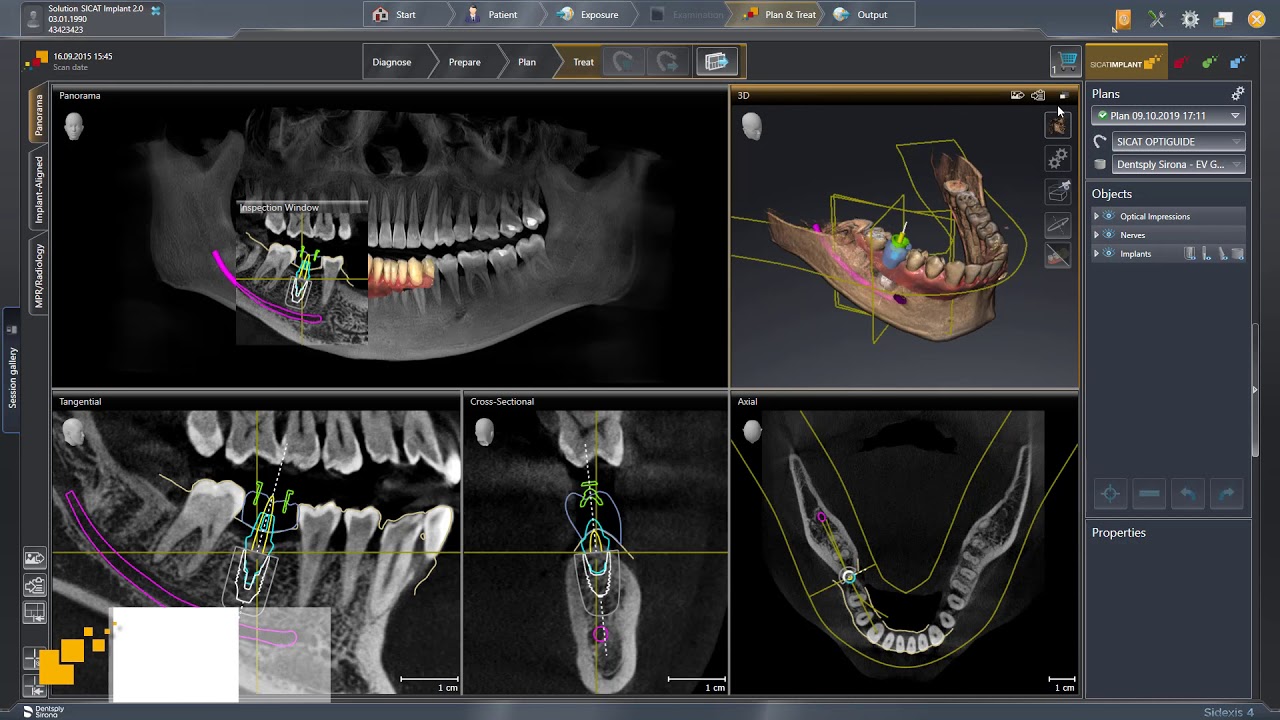 SICAT Implant 2.0 - Managing Plans