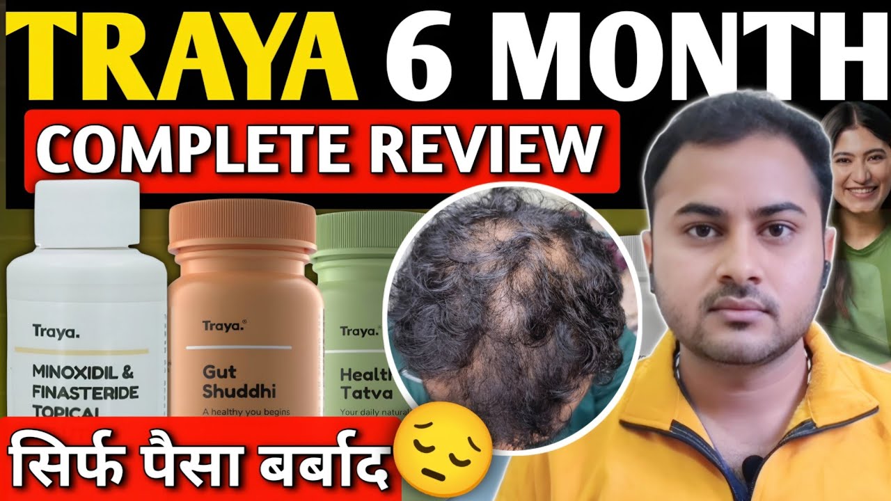 Traya Result After 6 Months | Traya Treatment Complete Review | Traya Hair Review 