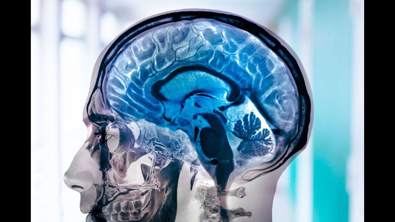 SEMIOLOGIA NEUROLOGICA (PARTE 1)