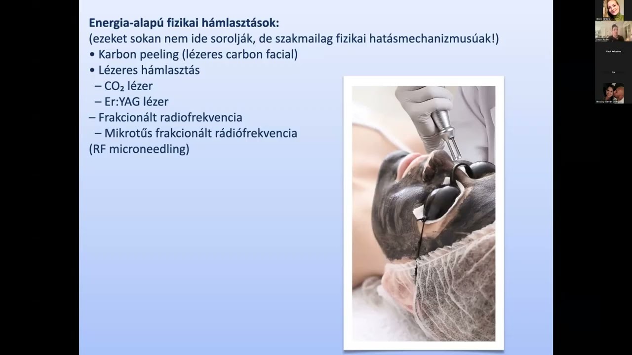 Gépi hámlasztó eljárások - Radics Zsuzsanna