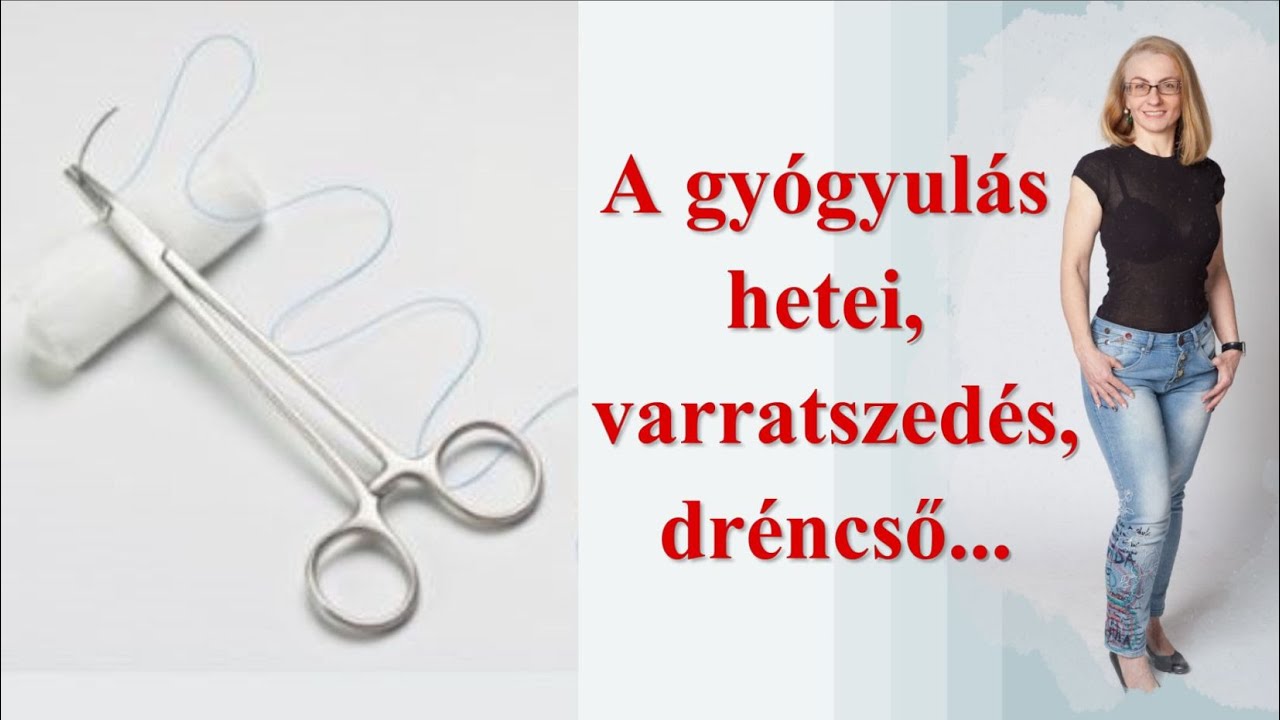 Varratszedés, kötözés, szorító ruha... a gyógyulás hetei hasplasztika után