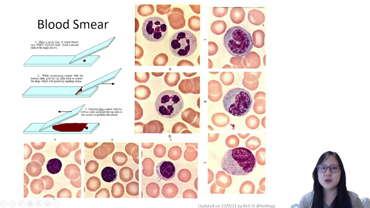 Chapter 8.1c - WBCs and RBCs  | Cambridge A-Level 9700 Biology