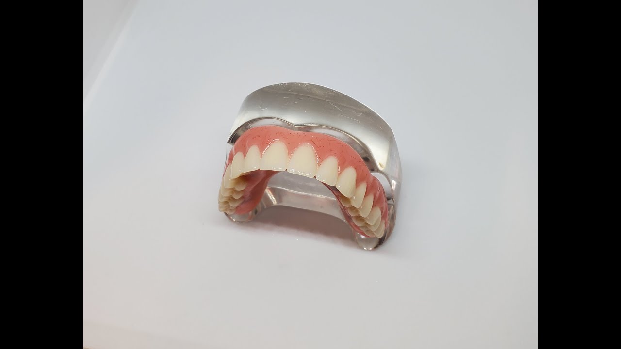 Upper denture implants