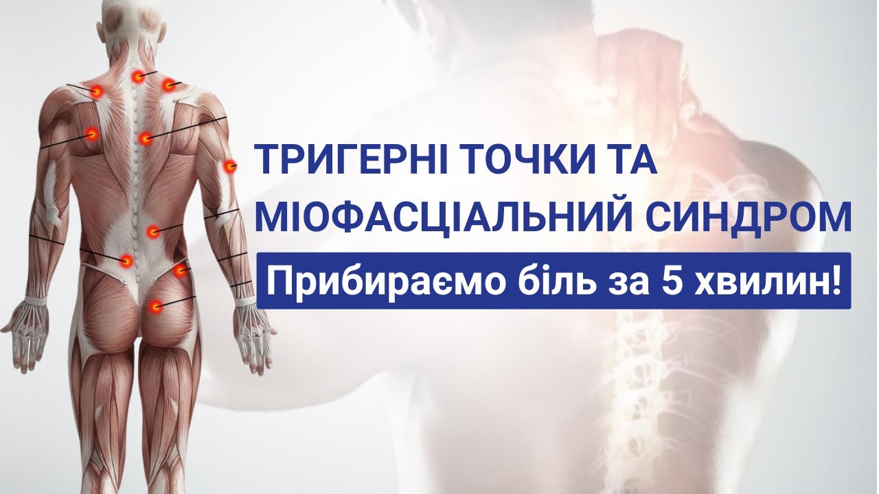 Масаж спини при тригерних точках та міофасціальному синдромі. Прибираємо біль за 5 хвилин!