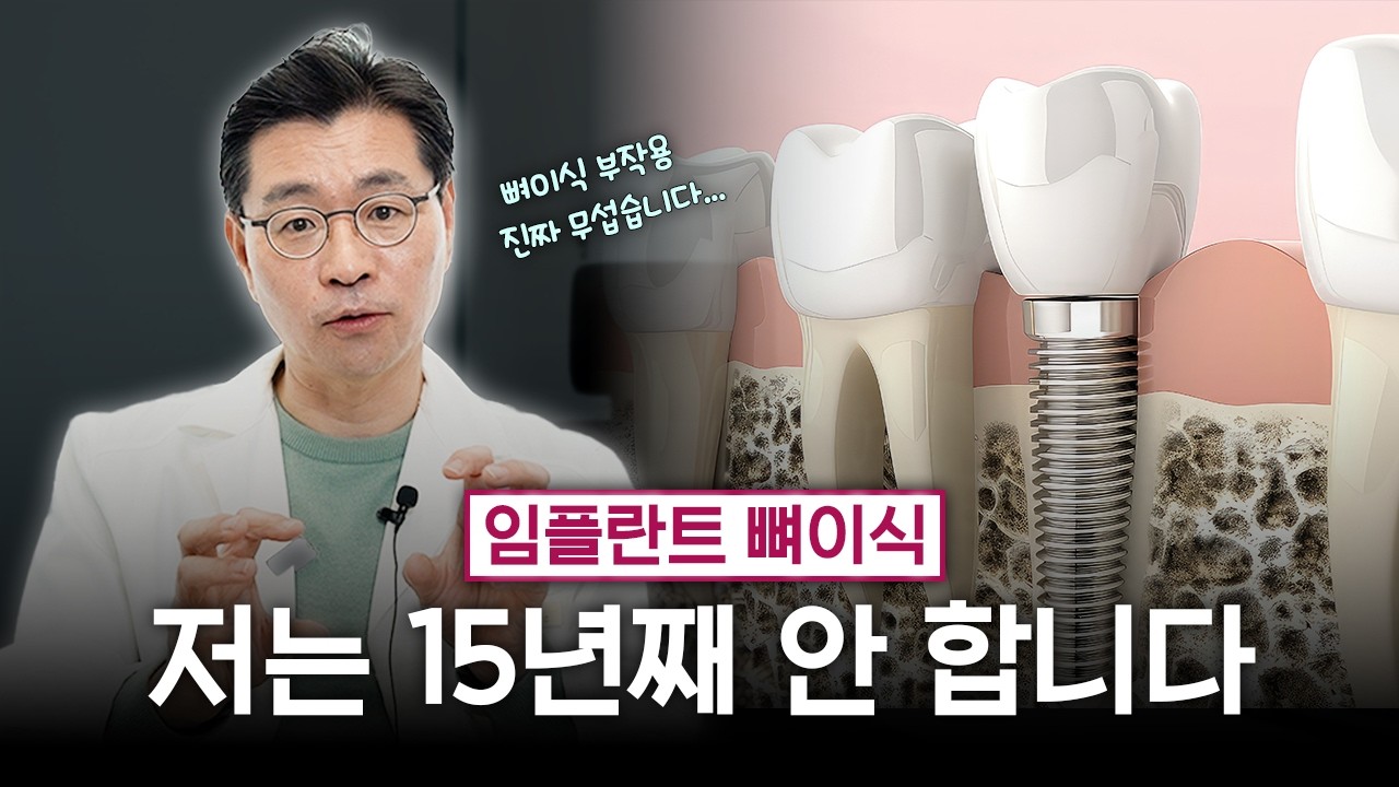 임플란트 뼈이식 진짜 필요할까? 저는 15년째 뼈이식 안 하고 임플란트 합니다