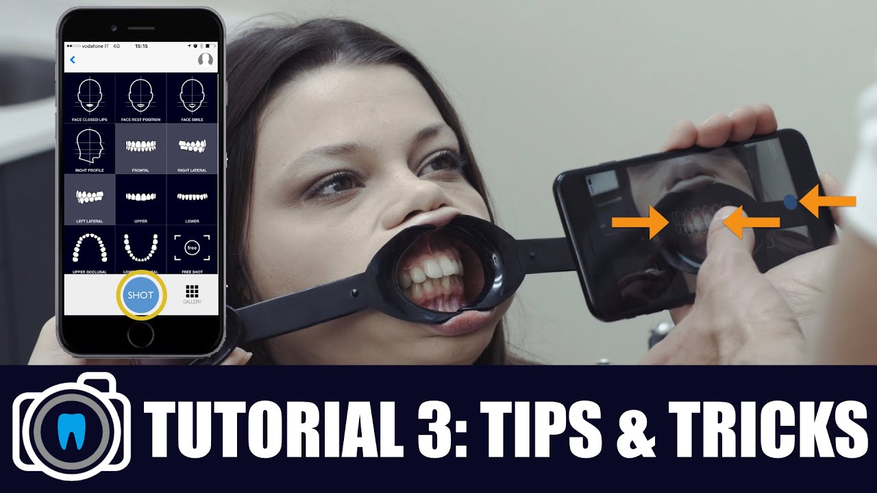 Dental Shooting: TUTORIAL 3/3 TIPS & TRICKS (MOBILE DENTAL PHOTOGRAPHY)