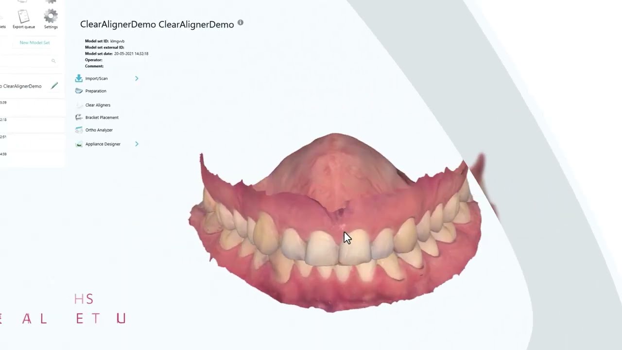 Clear Aligner Studio Commercial Video 2021