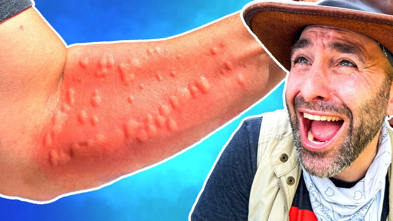 What DESTROYED my Arm? Caterpillar? Toxic Plant? Jungle Ants?