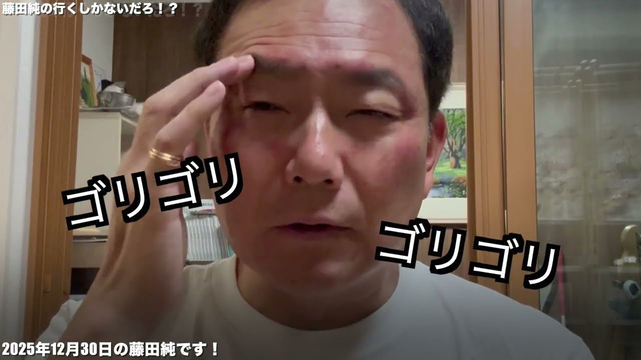 顔がボコボコに！？こんな時期だからできるカッピング施術受けてみた！