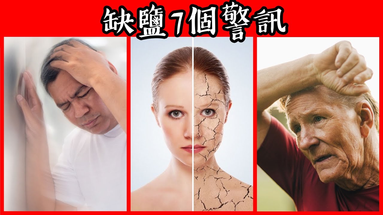 頭暈頭痛,缺鹽的7個症狀,失眠,抽筋,虛弱,怕熱等,補充好海鹽!,柏格醫生 Dr Berg