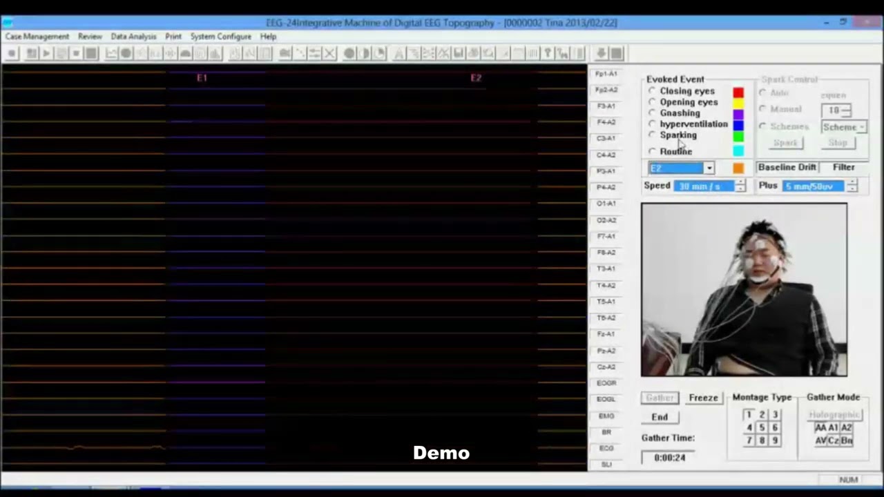 MY-H011B-N 24-Channel EEG System operation guide