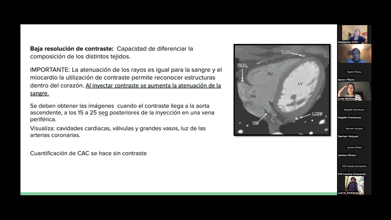 Seminario tomografía cardíaca