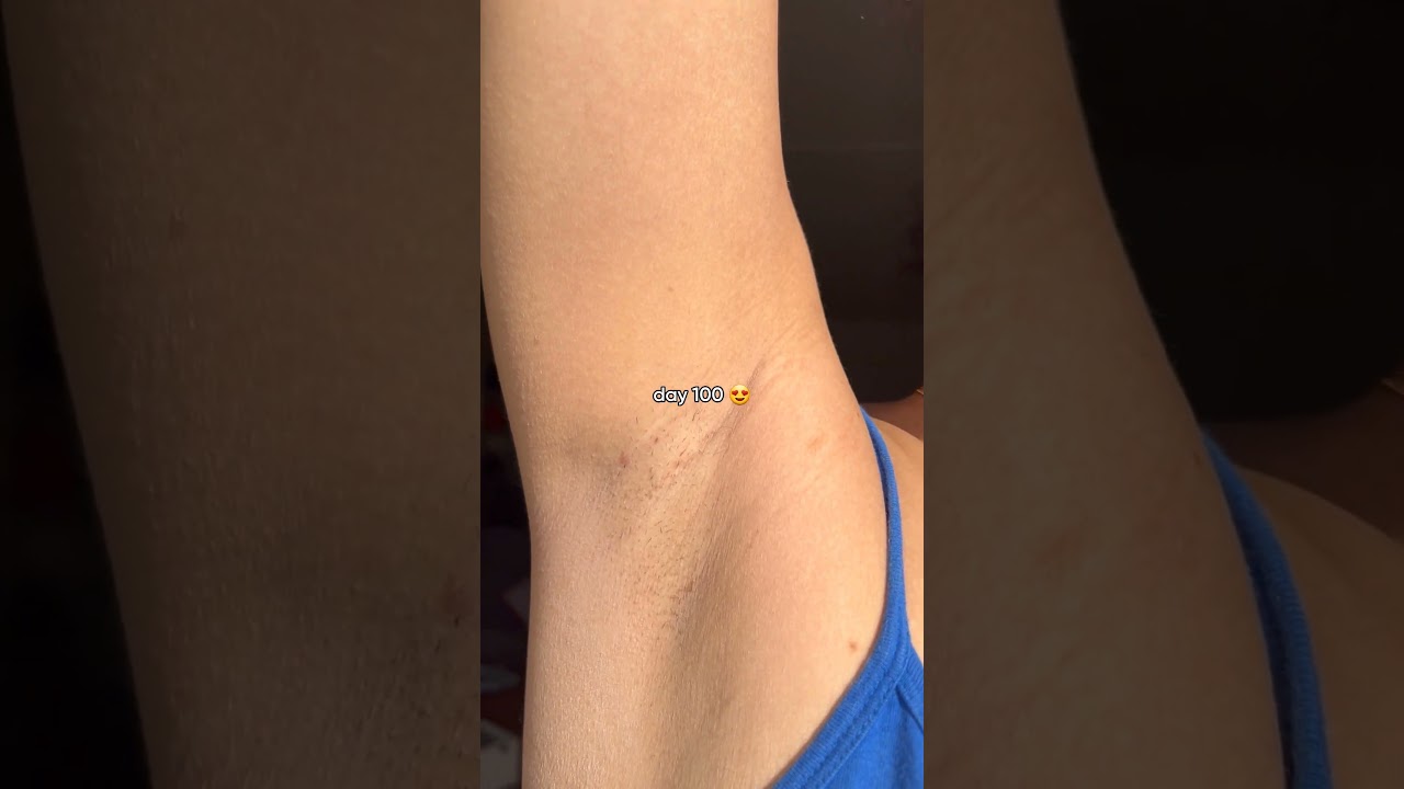 You can have permanently smooth skin in only 8-12 uses with Lumi!   #hairremoval