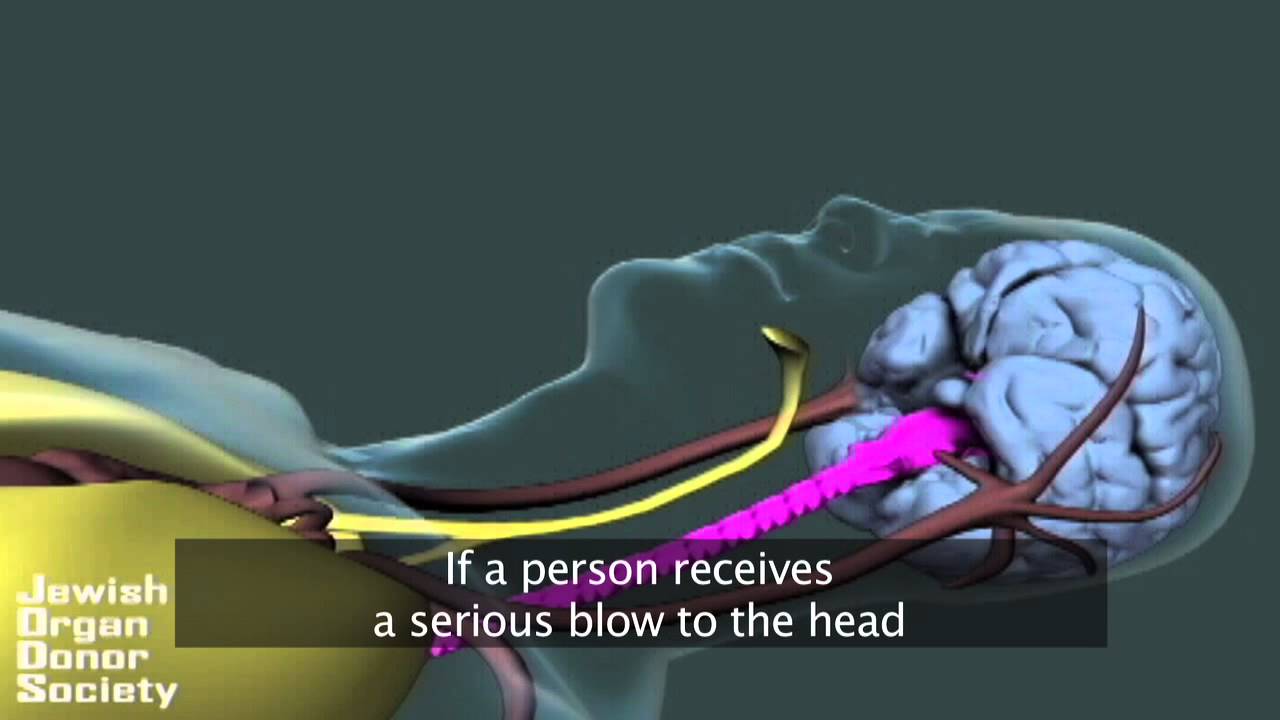 What is Brain Death? (Hindi with subtitles)