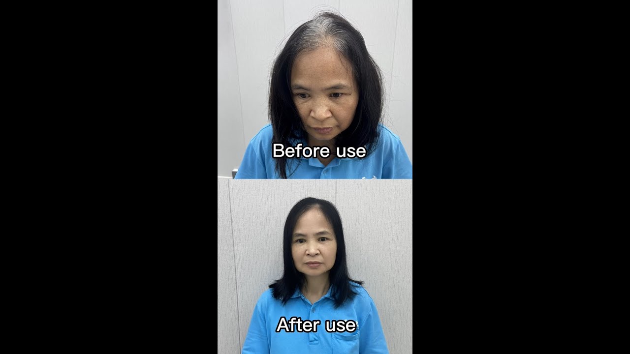 10 Minutes From Grey Hair To Black | Black Hair Dye Shampoo