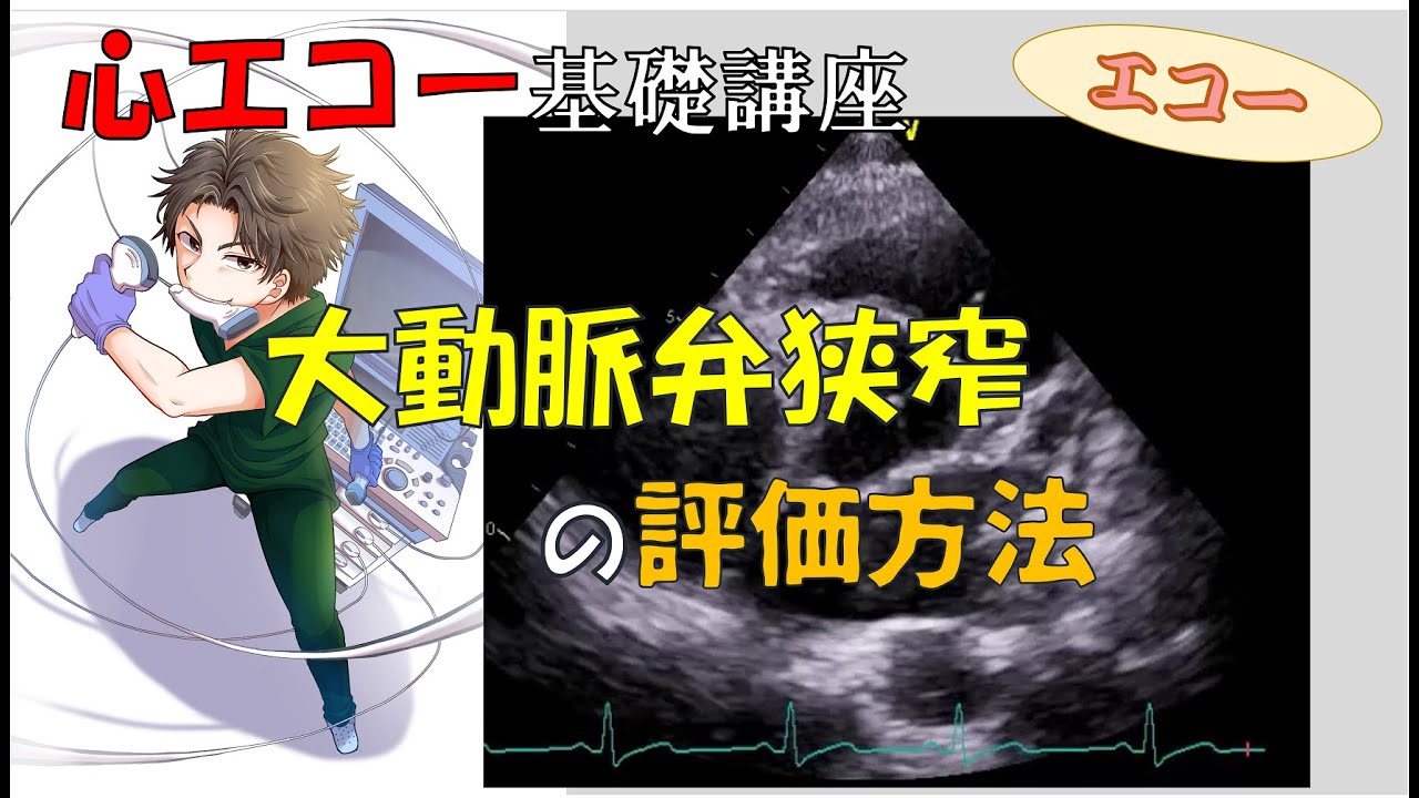 【心エコー】これで完璧！大動脈弁狭窄の観察と評価法！