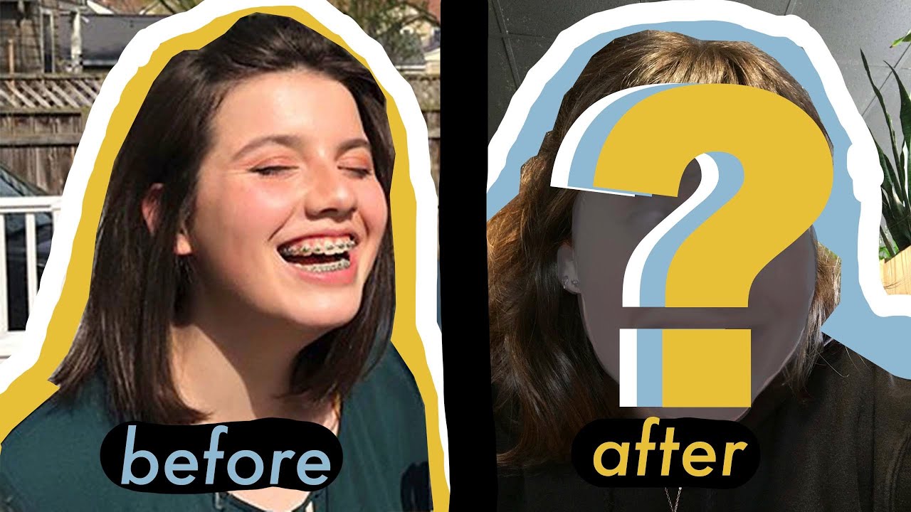 getting my braces off