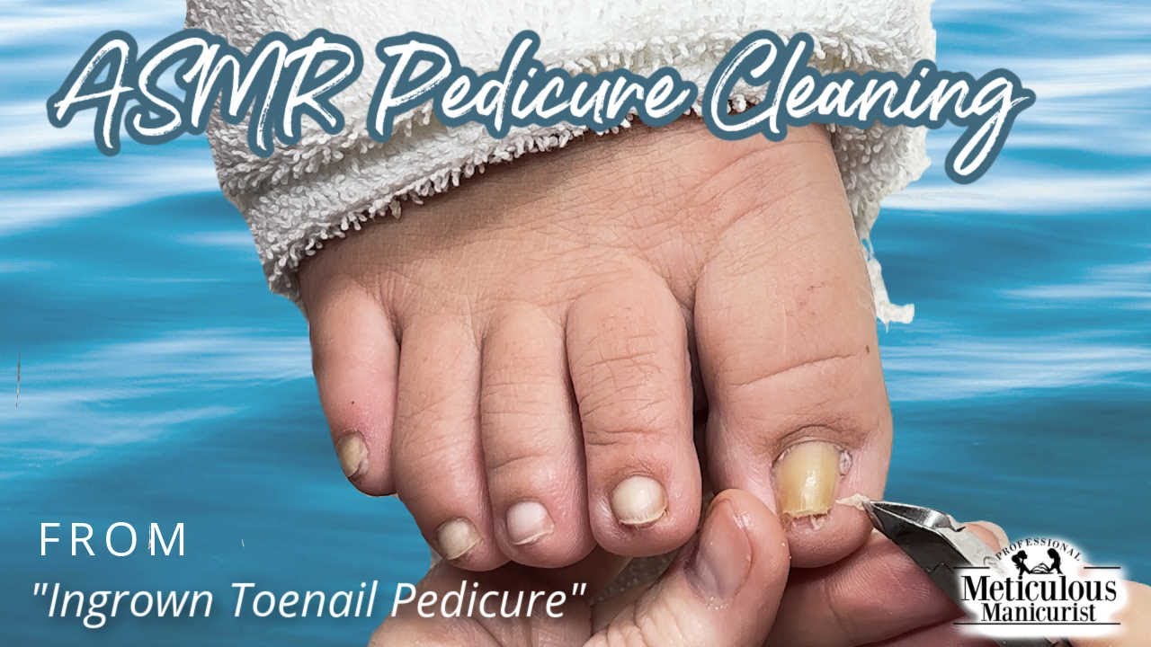 👣ASMR Pedicure Cleaning💆&zwj;♀️Ingrown Toenail Pedicure👣