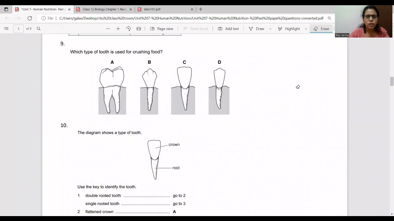 Unit 7- Human nutrition- Past paper questions- Cambridge IGCSE 0610
