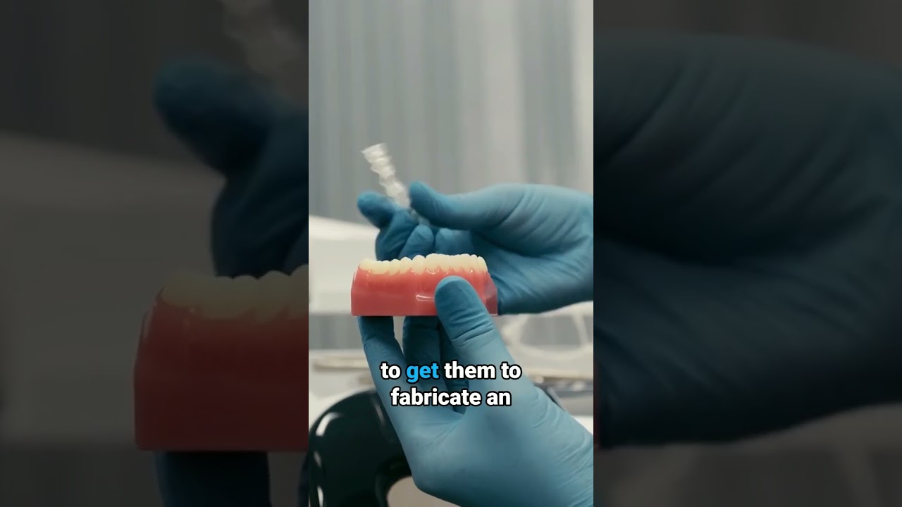 The Process of getting an Occlusal Splint