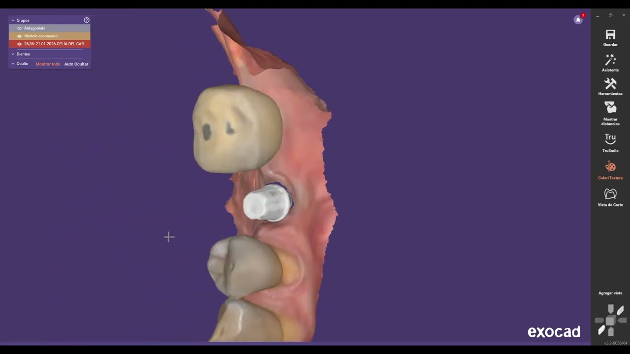 Diseño sobre Pilar Externo