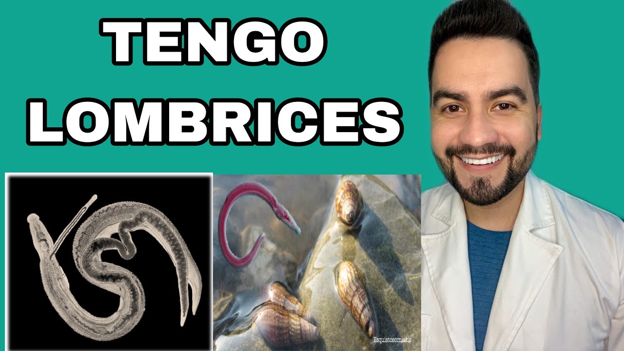 I HAVE WORMS / SCHISTOSOMIASIS | DR. DAVID CAMPOS