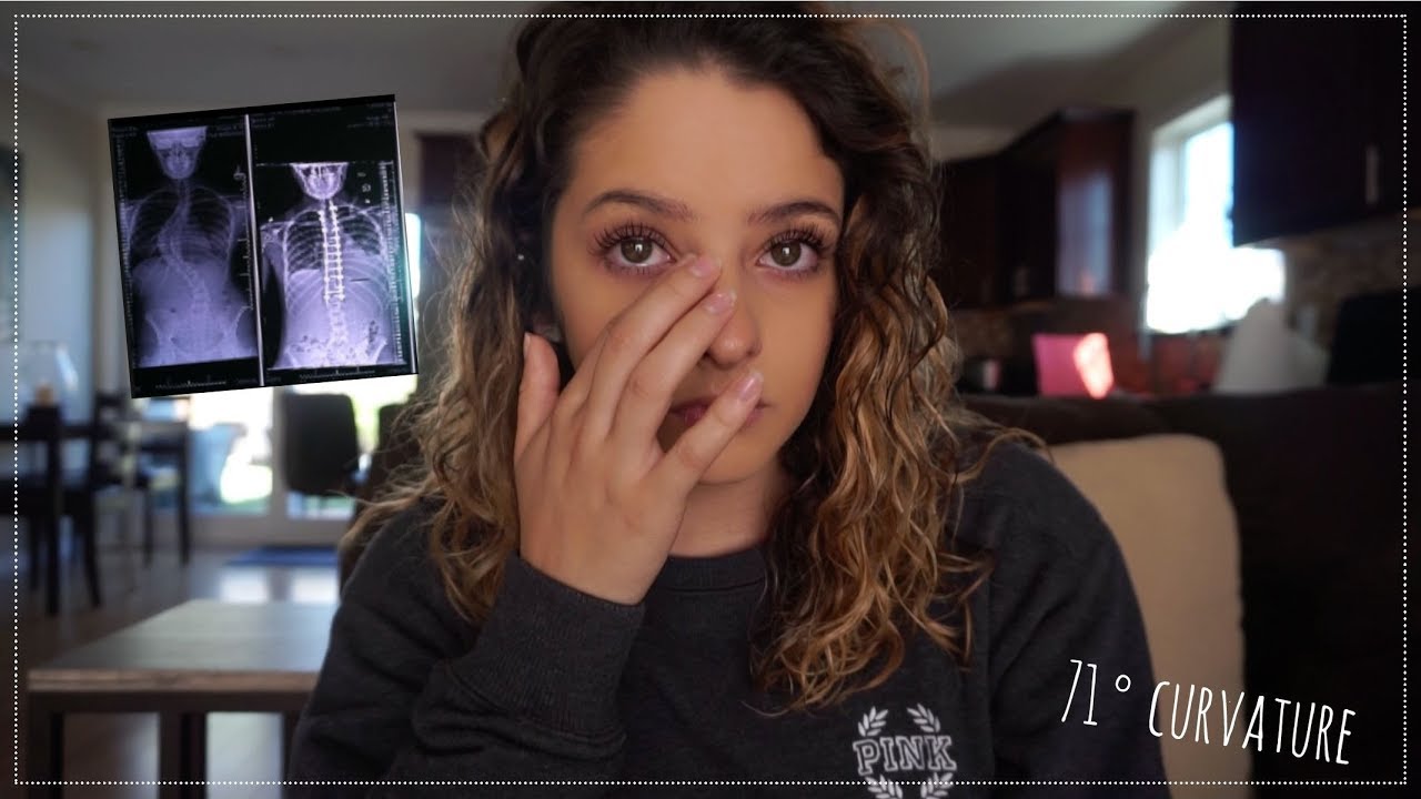 My Scoliosis Story