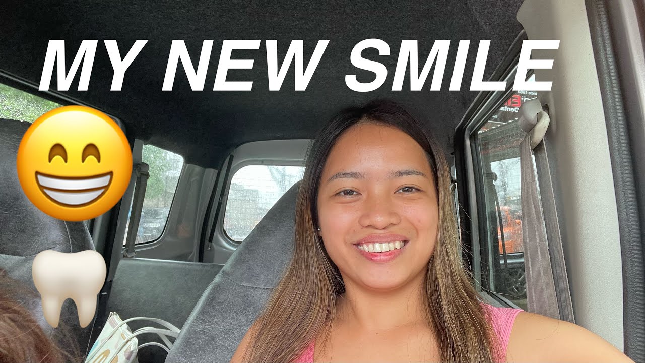 My new smile/Good Dentist in Dumaguete Philippines