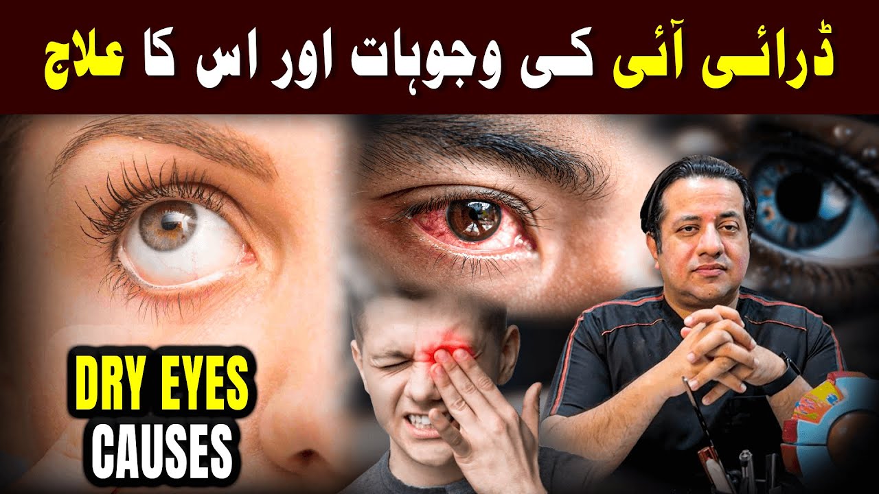 Best Treatment for Dry Eyes | Causes, Symptoms & Solutions Urdu/Hindi