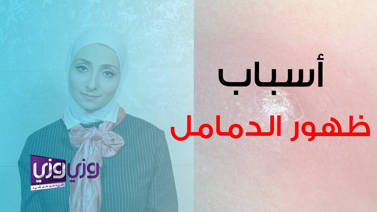أسباب ظهور الدمامل وعلاجها