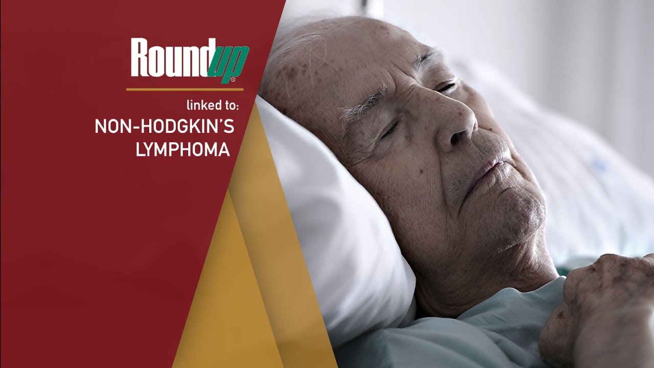 RoundUp is Linked to Non-Hodgkin's Lymphoma!